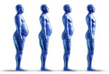 Photo of Bariatric Surgery
