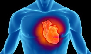Photo of Angioplasty